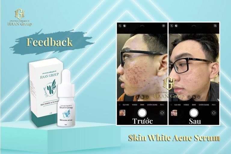 Tinh chất Skin Acne Serum – Chân ái trong chu trình Skincare
